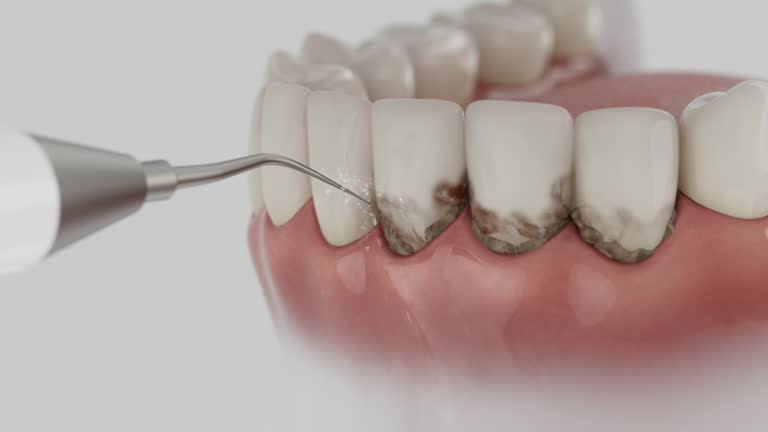 Reliable Teeth Cleaning And Checkup contractor in Lewis County County, MO by Dentist Open Now